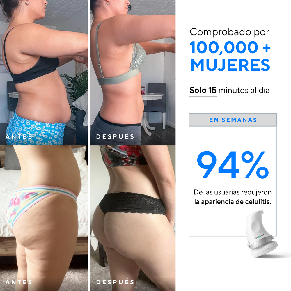 Vista de las almohadillas intercambiables VibroSculpt